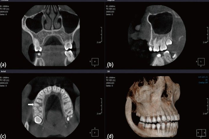 digital-dentistry-cbct
