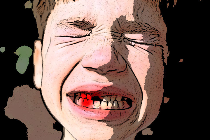 kid-dental-injury
