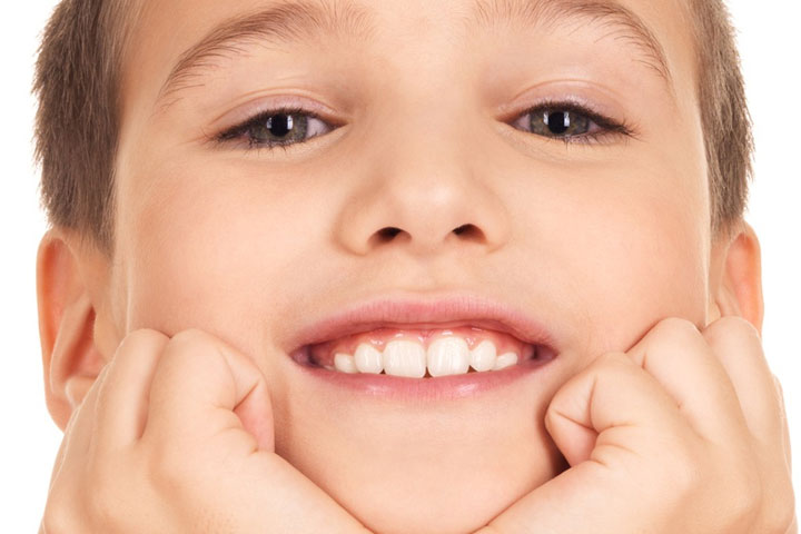 restorative-dentistry-in-kids